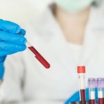 Алкоголь и биохимеческий анализ крови